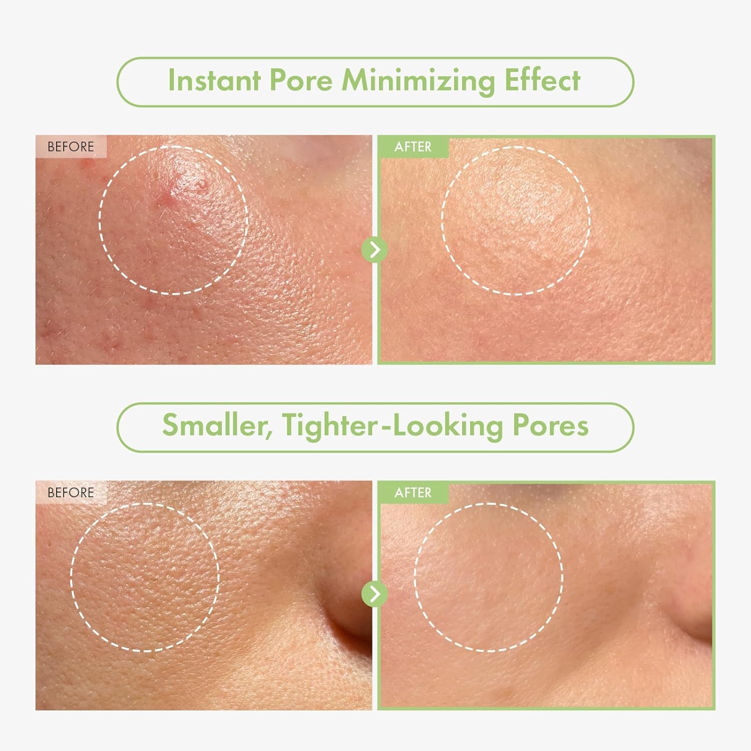 Ultimate Pore Control Duo: TOSOWOONG Green Caviar Ampoule and Cica Primer for Hydration and Makeup Perfection - view 3