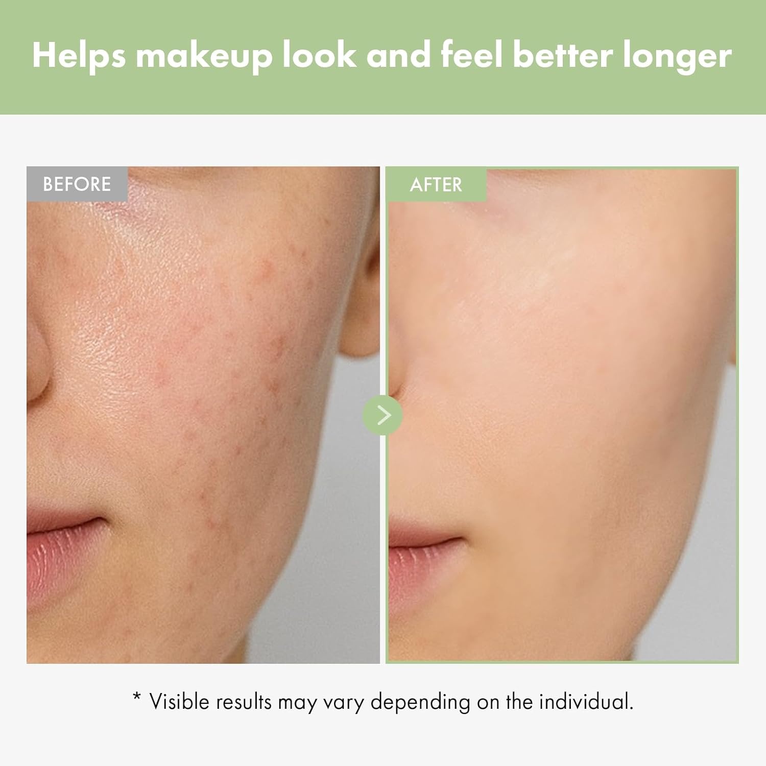 Ultimate Pore Control Duo: TOSOWOONG Green Caviar Ampoule and Cica Primer for Hydration and Makeup Perfection - view 8