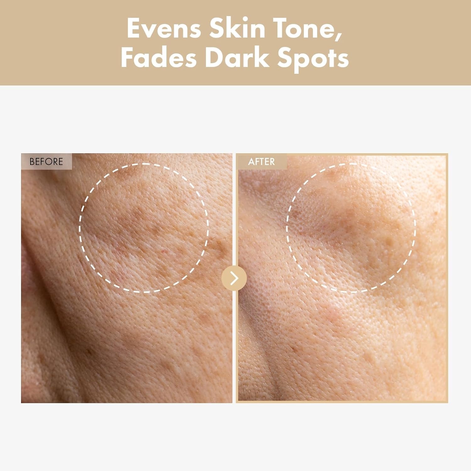 TOSOWOONG Complexion Perfection Duo: Arbutin 7 Tranexamic Acid 4 Cream and Rice Milky Toner for Enhanced Radiance and Hydration - view 5