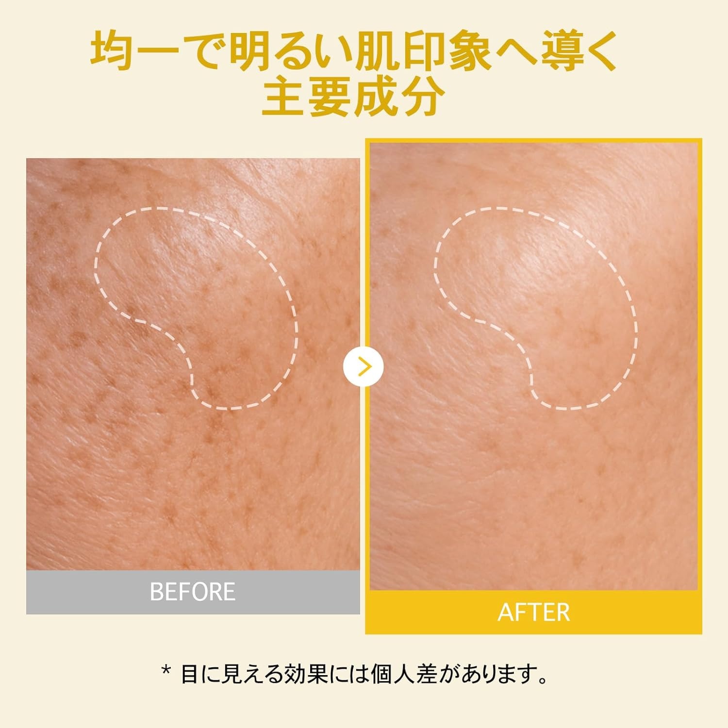 TOSOWOONG K-Beauty Viral Glass Skin Mask Trio – Real Collagen for Elasticity + Kojic Acid Turmeric for Dark Spots + PDRN Salmon DNA for Firming – Peel Off Facial Mask Set - view 5