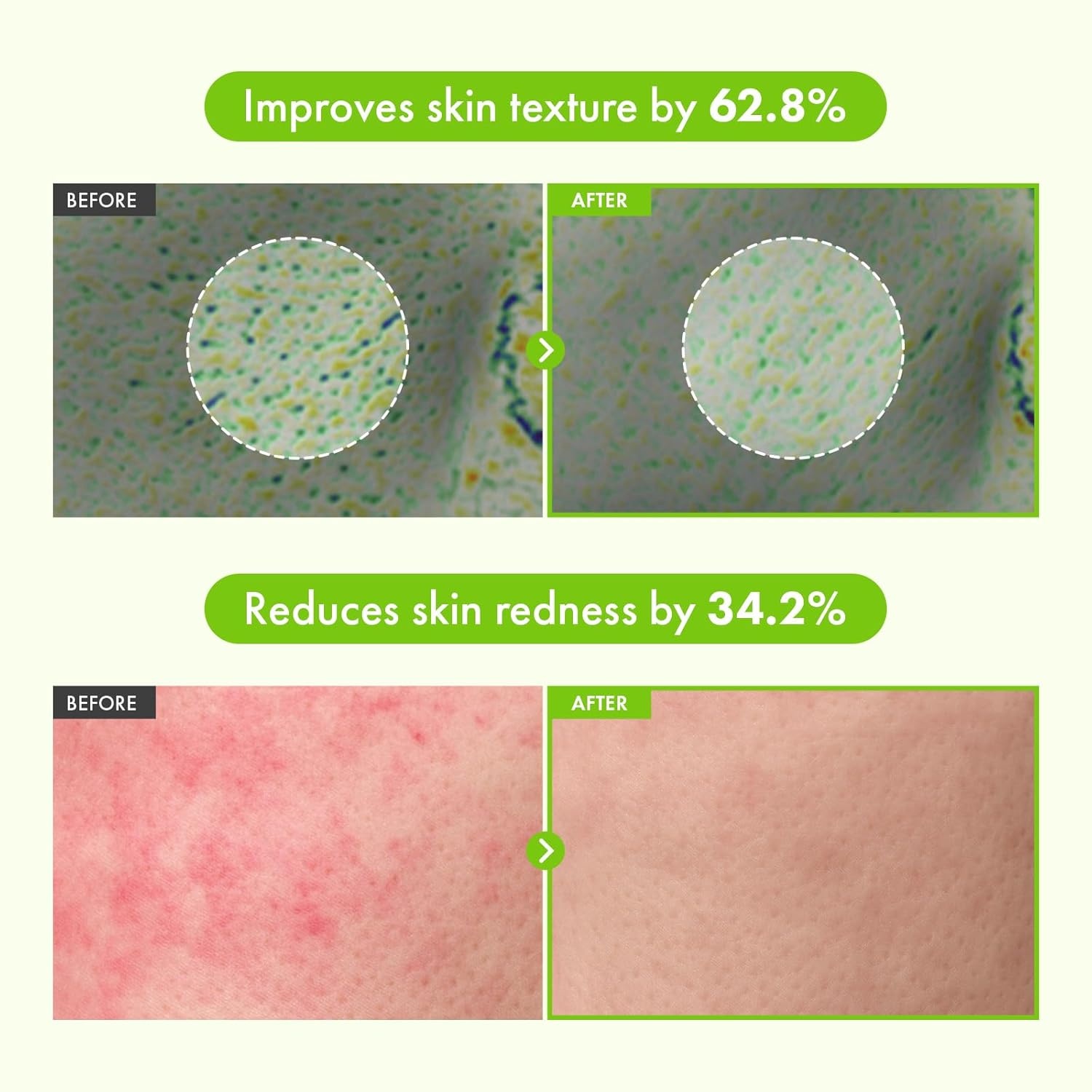 TOSOWOONG Panthenol Barrier Duo – 5% Green Tea Serum (1.11oz) & 20% Intensive Repair Cream (1.69oz) – Soothing & Hydrating Kit for Sensitive Skin - view 3