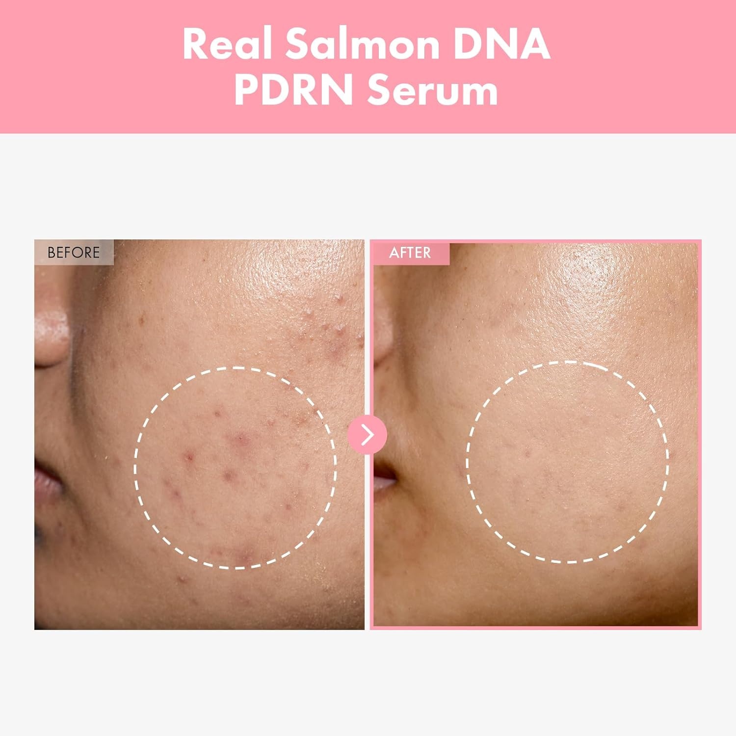 TOSOWOONG Tone & Texture Repair Kit: Real Rice Glow Serum and Pink Peptide 12 PDRN Serum – Daily Face Glow Routine for Dullness and Fine Lines - view 5