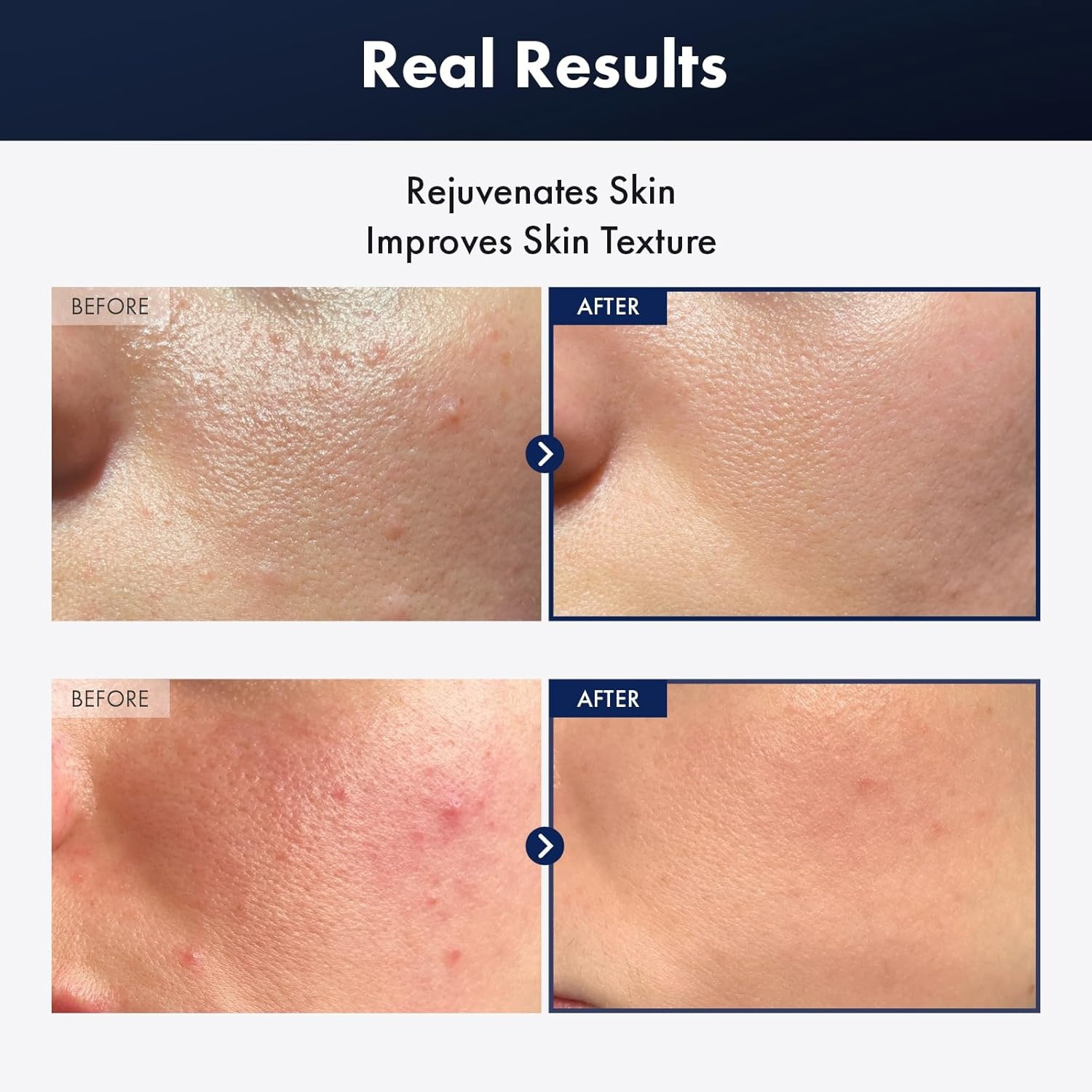TOSOWOONG Snail & Radiance Repair Set – 96% Black Snail Mucin Essence for Hydration + Arbutin 7% Tranexamic Acid 4% Cream for Dark Spots – Post-Acne Mark Care K-Beauty Bundle - view 2