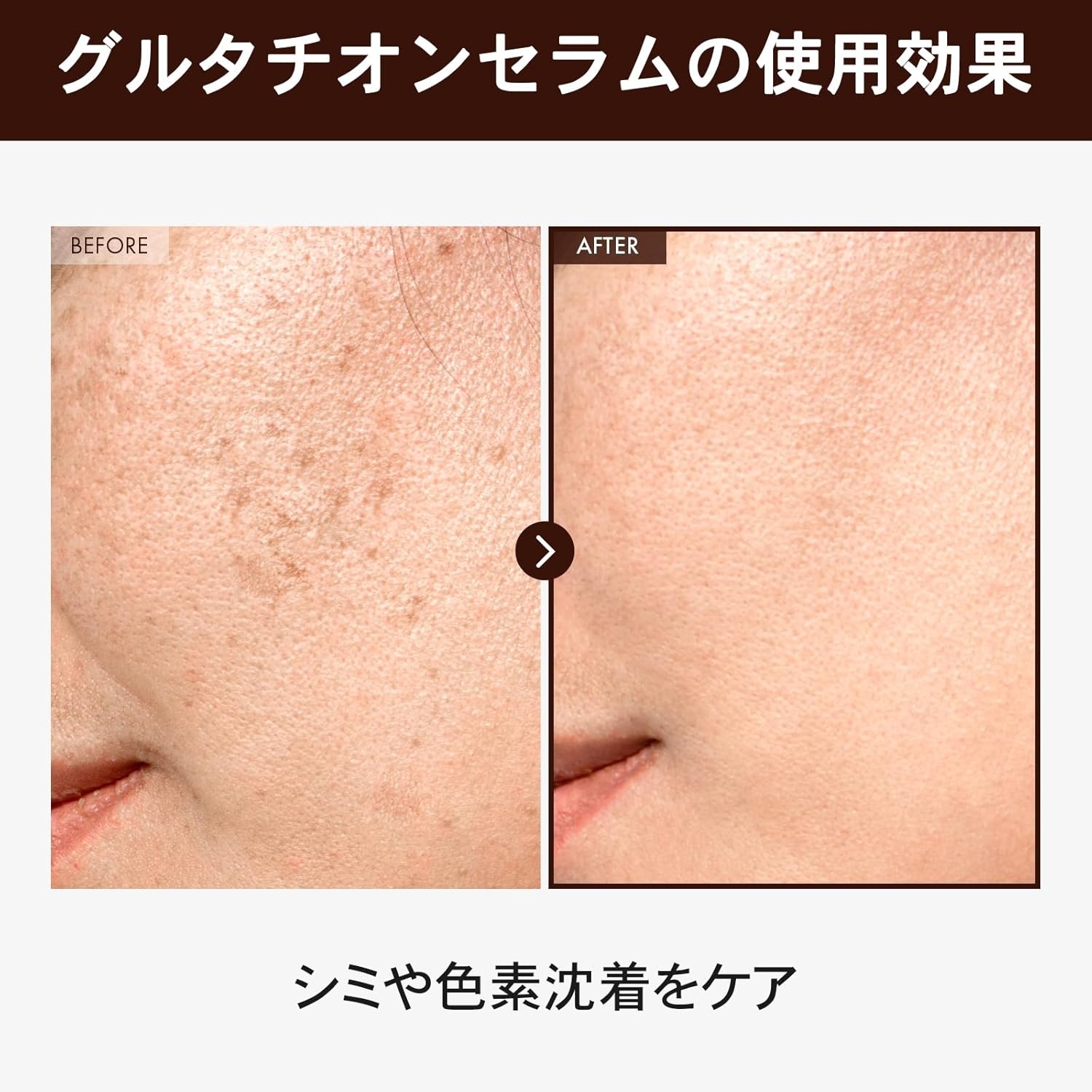 Radiant Skin Duo: TOSOWOONG Glutathione Serum & Arbutin 7 Glutathione Cream for Radiance and Spot Correction - view 2