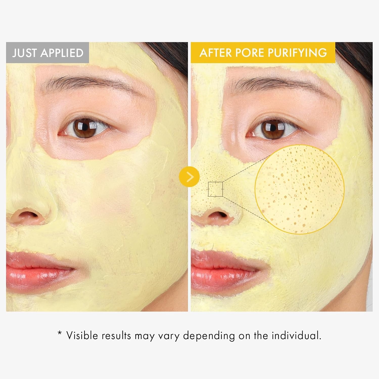 TOSOWOONG Kojic Acid & Turmeric Duo – Pore Purifying Mud Mask (3.52oz) & Triple-Layer Serum (1.11oz) – Targeted Dark Spot Care & Skin Clarity Kit for Glass Skin - view 3