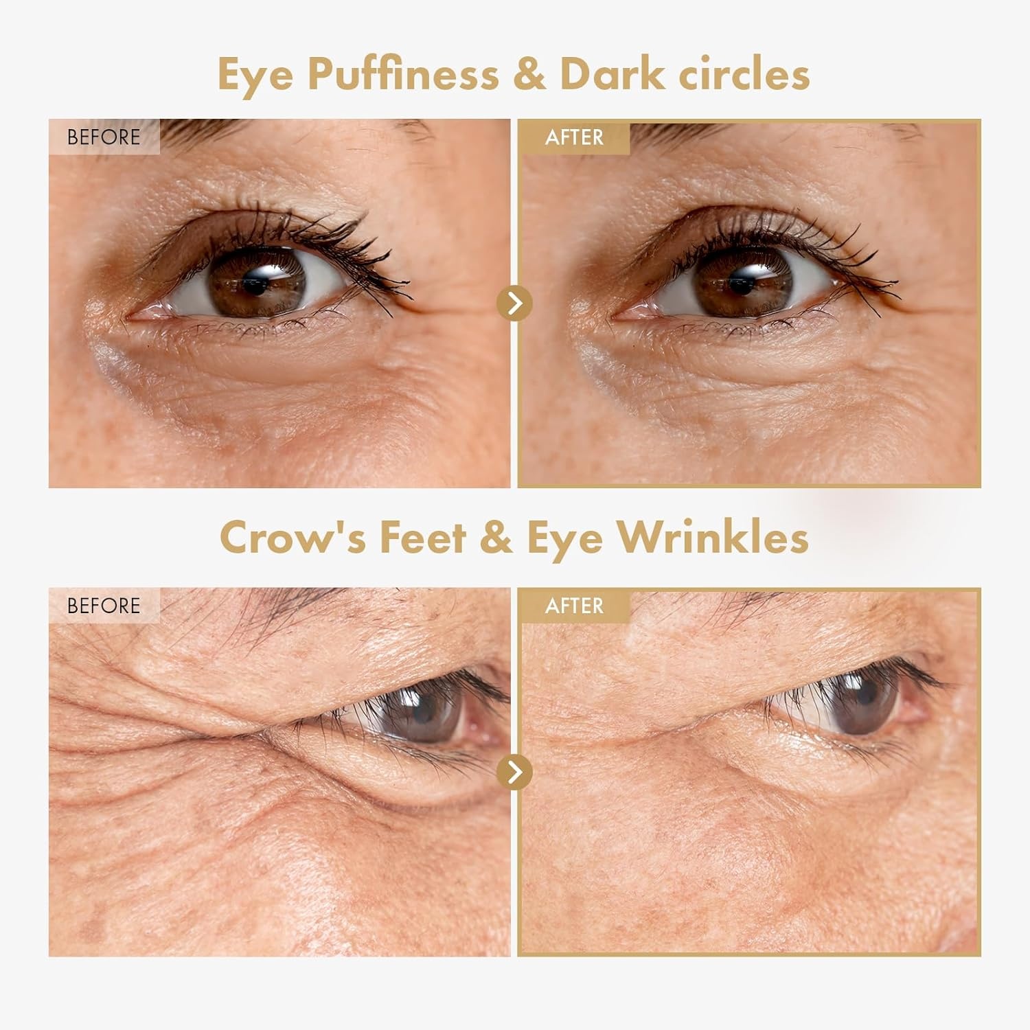 Glow & Revitalize Duo: TOSOWOONG Real Turmeric Kojic Acid Serum & Ginseng Plus Retinal Eye Serum for Glowing Skin - view 5