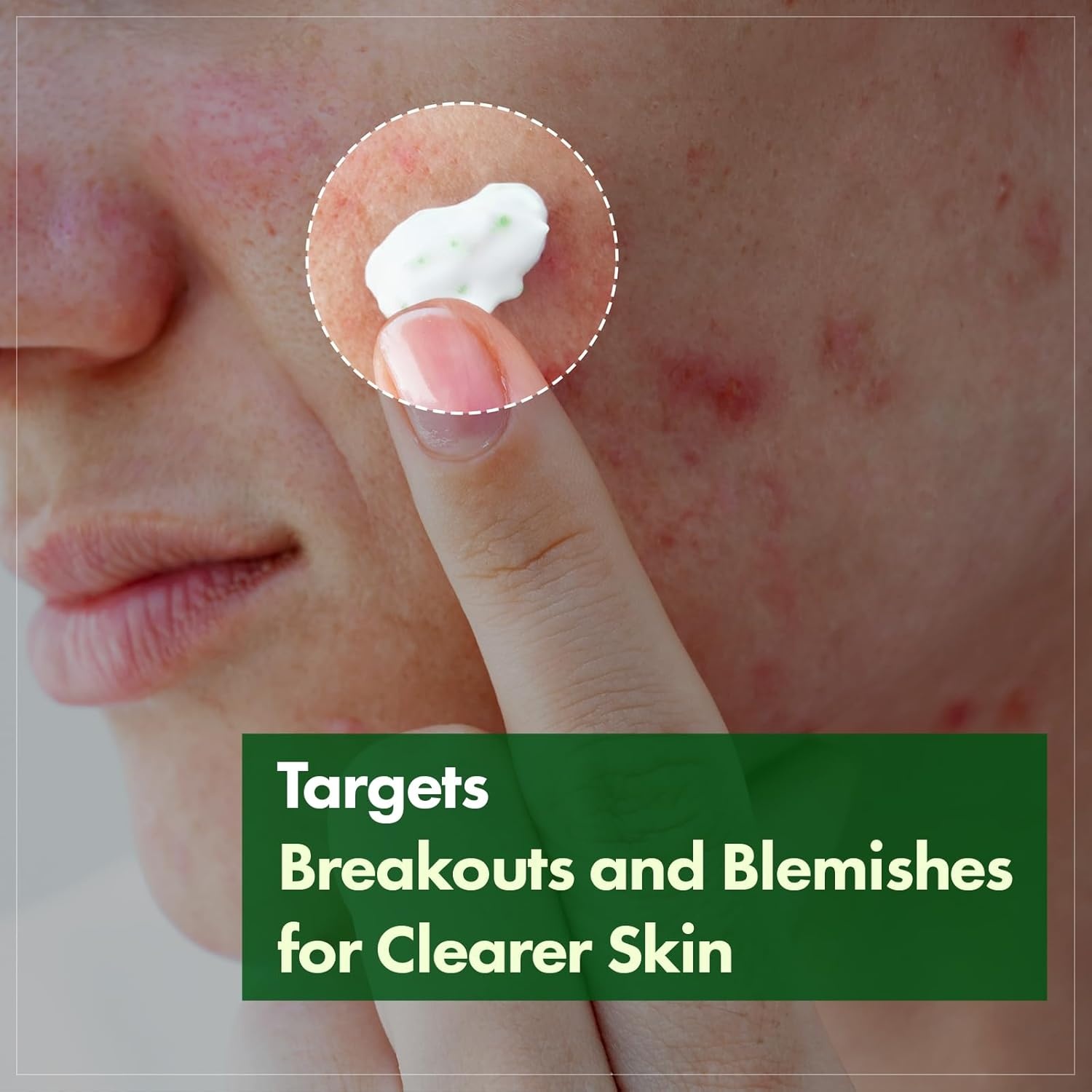 TOSOWOONG Soothing Skin Care Duo: Madagascar Centella Ampoule & Cream for Rapid Relief and Hydration - view 5