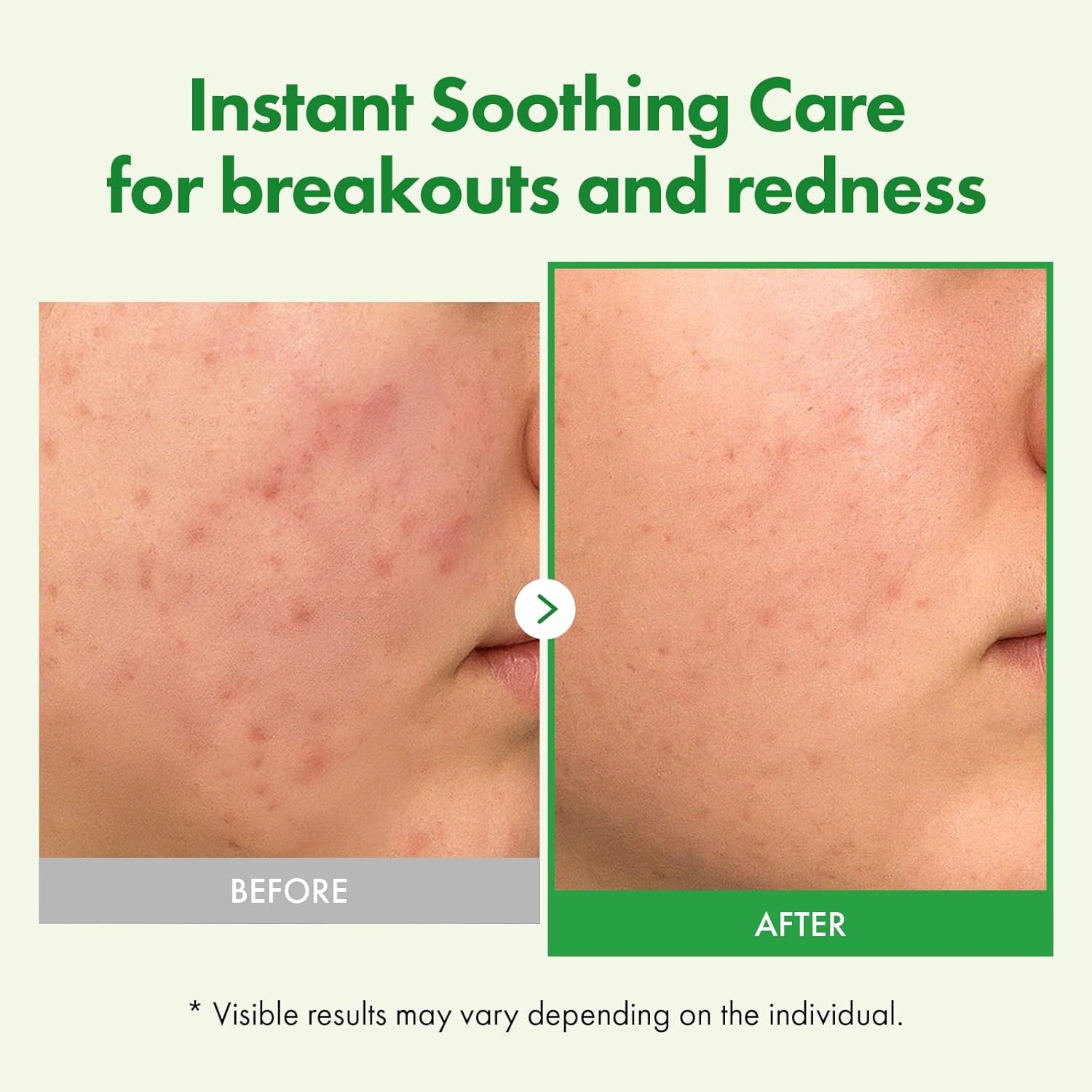 TOSOWOONG Soothing Skin Care Duo: Madagascar Centella Ampoule & Cream for Rapid Relief and Hydration - view 7