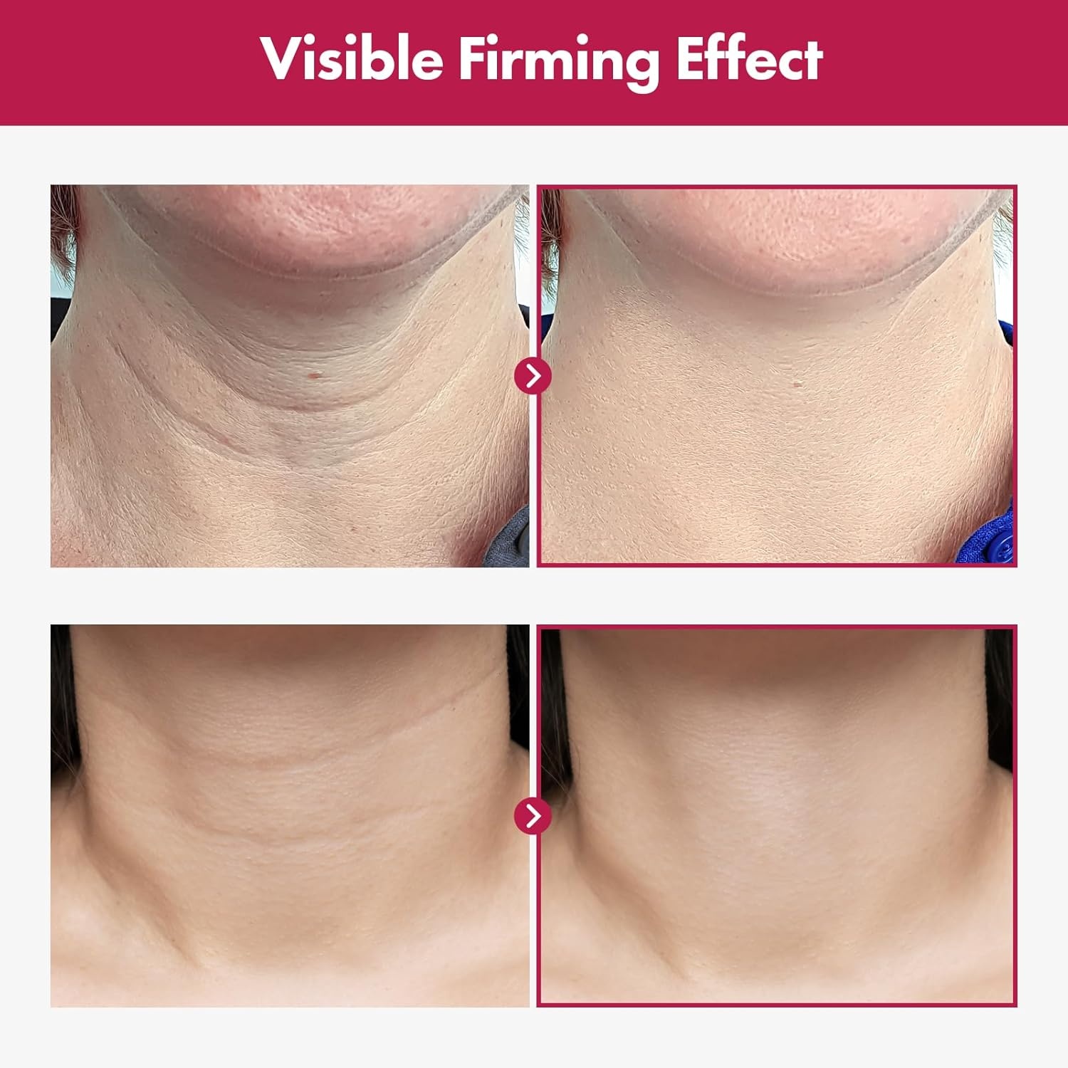 TOSOWOONG Youthful Neck & Eye Duo Collagen Necktox Cream & VITA Clinic Vitamin Eye Cream for Firmness and Hydration - view 3