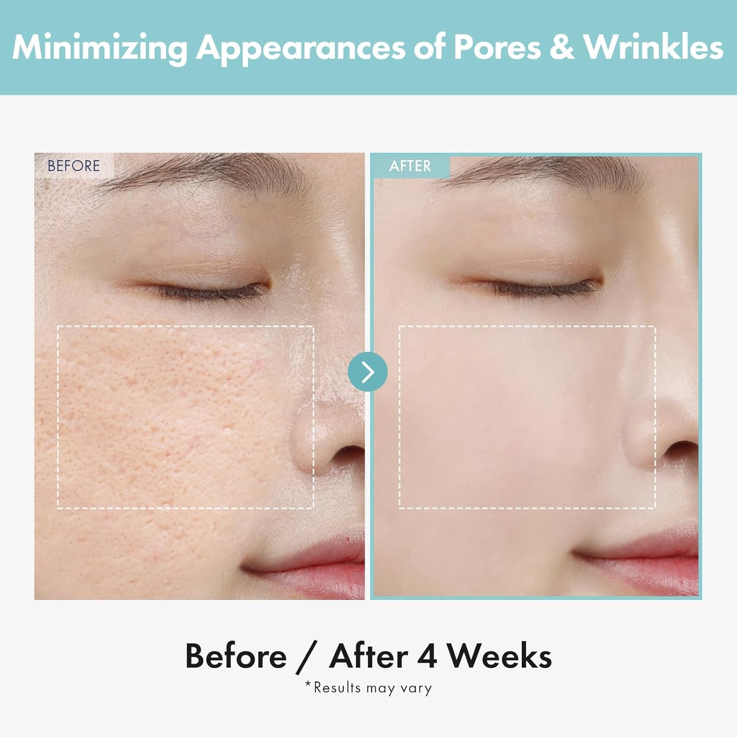 TOSOWOONG Pore Perfection Duo Pore Refiner Cream & Green Caviar Pore Ampoule for Smooth, Refined Skin - view 3