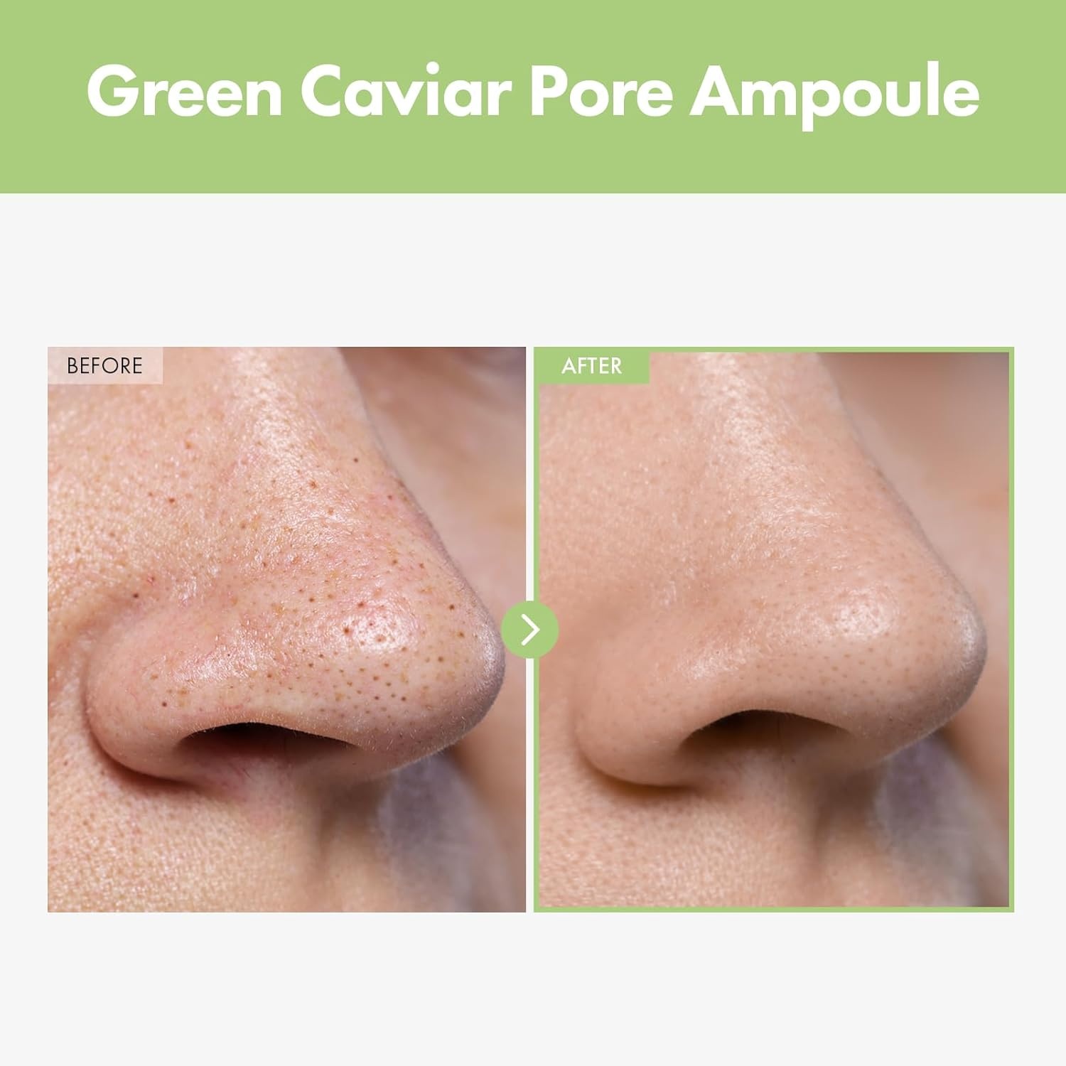 TOSOWOONG Pore Perfection Duo Pore Refiner Cream & Green Caviar Pore Ampoule for Smooth, Refined Skin - view 5