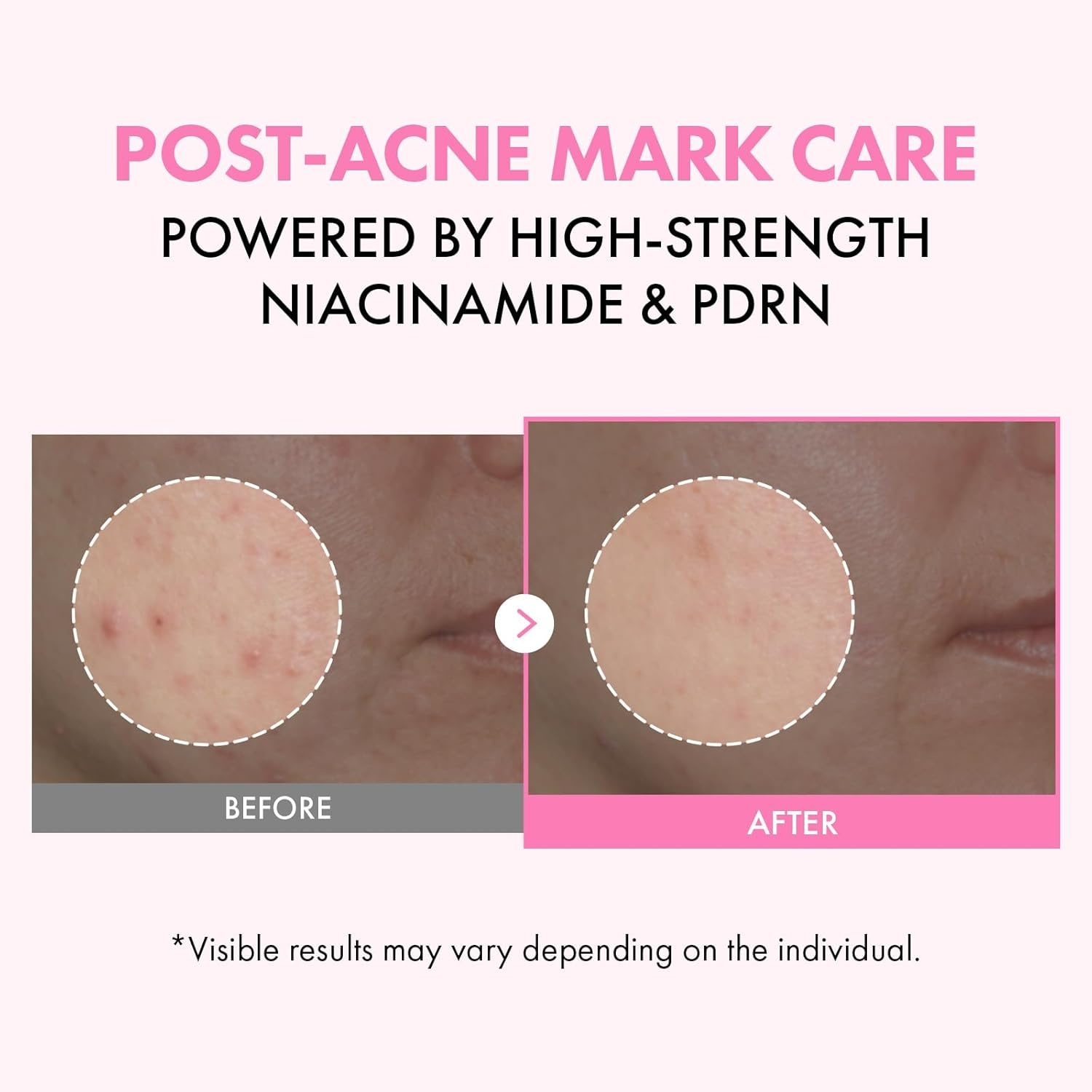 TOSOWOONG PDRN Niacinamide Blemish Care Bundle: Milky Facial Toner & Moisturizing Cream with 50,000ppm Niacinamide & Salmon DNA – Targets Dark Spots & Uneven Skin Tone - view 6