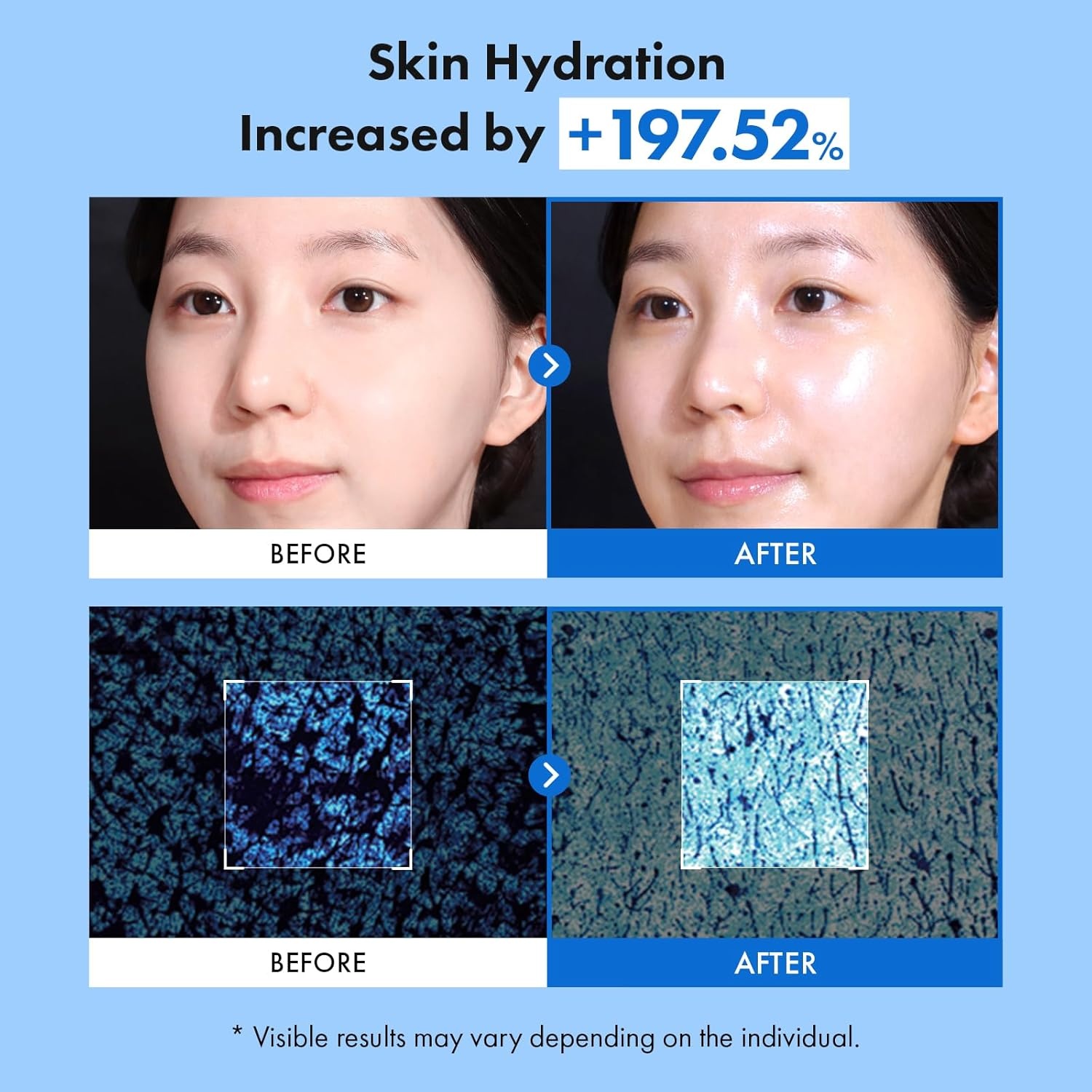 TOSOWOONG Hyaluronic Acid Duo – 8 Hyaluron Skin Booster Serum (5.07 fl. oz) & Hyaluronic Acid 9 Cream Set – Deep Multi-Layer Hydration & Glow Boosting Korean Skincare Kit - view 3