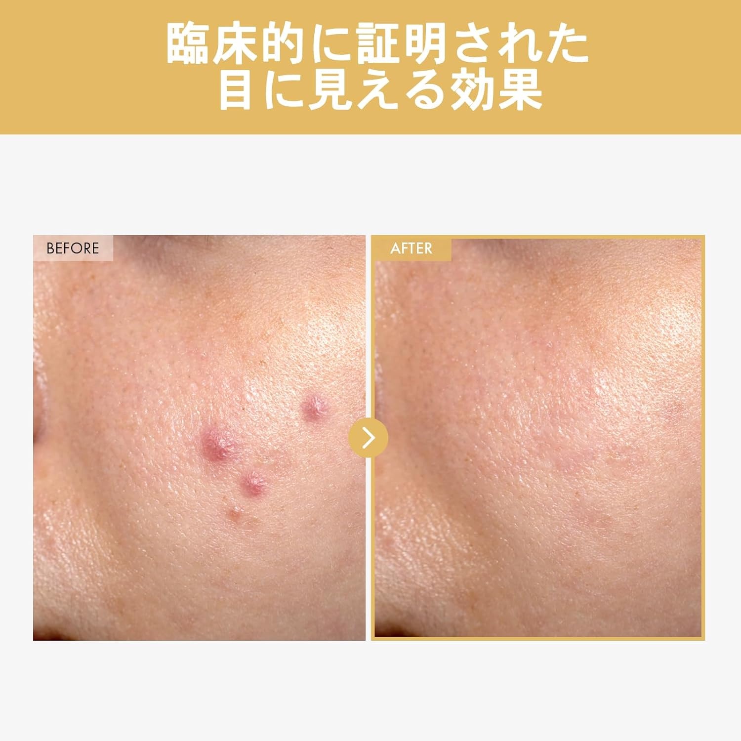 TOSOWOONG K-Beauty Anti-Aging Duo, Black Snail Ginseng Serum and Copper Peptide 12 Cream, Korean Skincare Set with Snail Mucin, Ginseng 640,430ppm, GHK-Cu, 12 Peptides for Hydrating Firming Glow - view 2