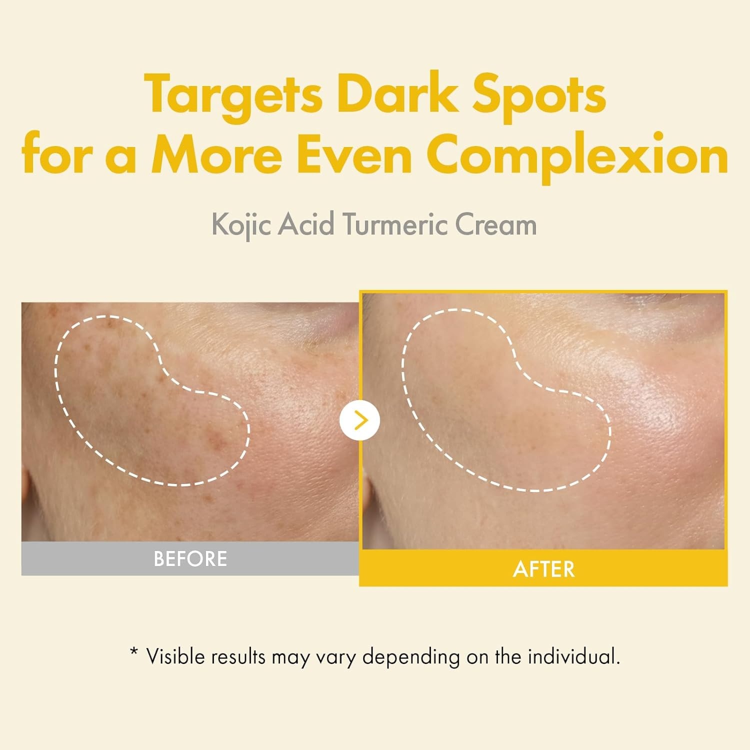 TOSOWOONG High Potency Active Duo: 99% Pure Kojic Acid Moisturizer & Copper Tripeptide-1 Collagen Booster – Fade Hyperpigmentation and Restore Elasticity - view 2