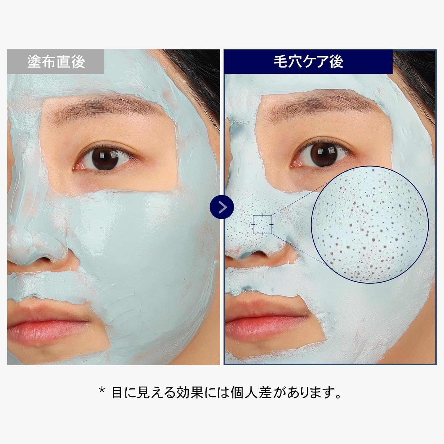TOSOWOONG K-Beauty Pore Purifying Duo Blackhead Mask and Green Caviar Serum for Tightening and Hydration - view 3