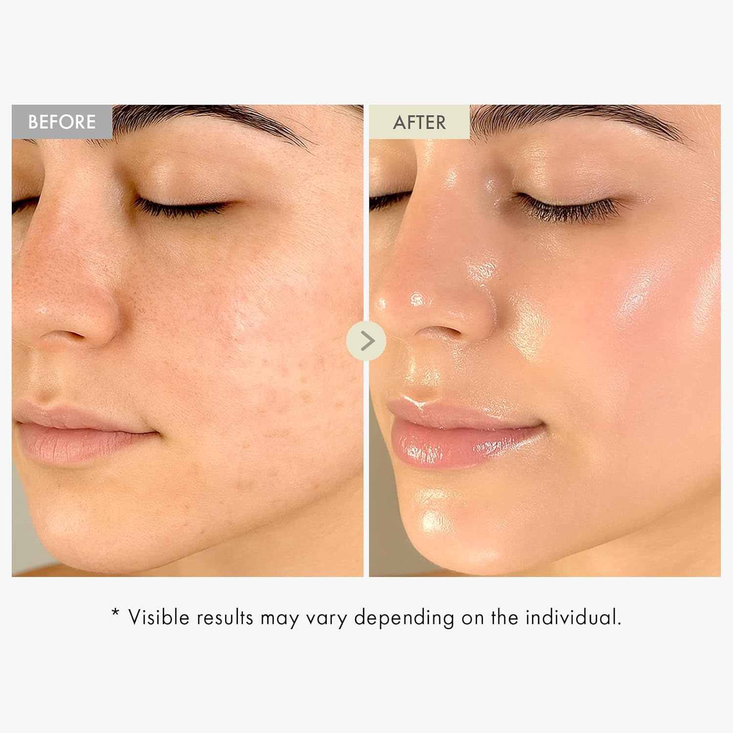 TOSOWOONG Collagen Glow Duo: Real Collagen Fit & Face Serum for Youthful Glow - view 6