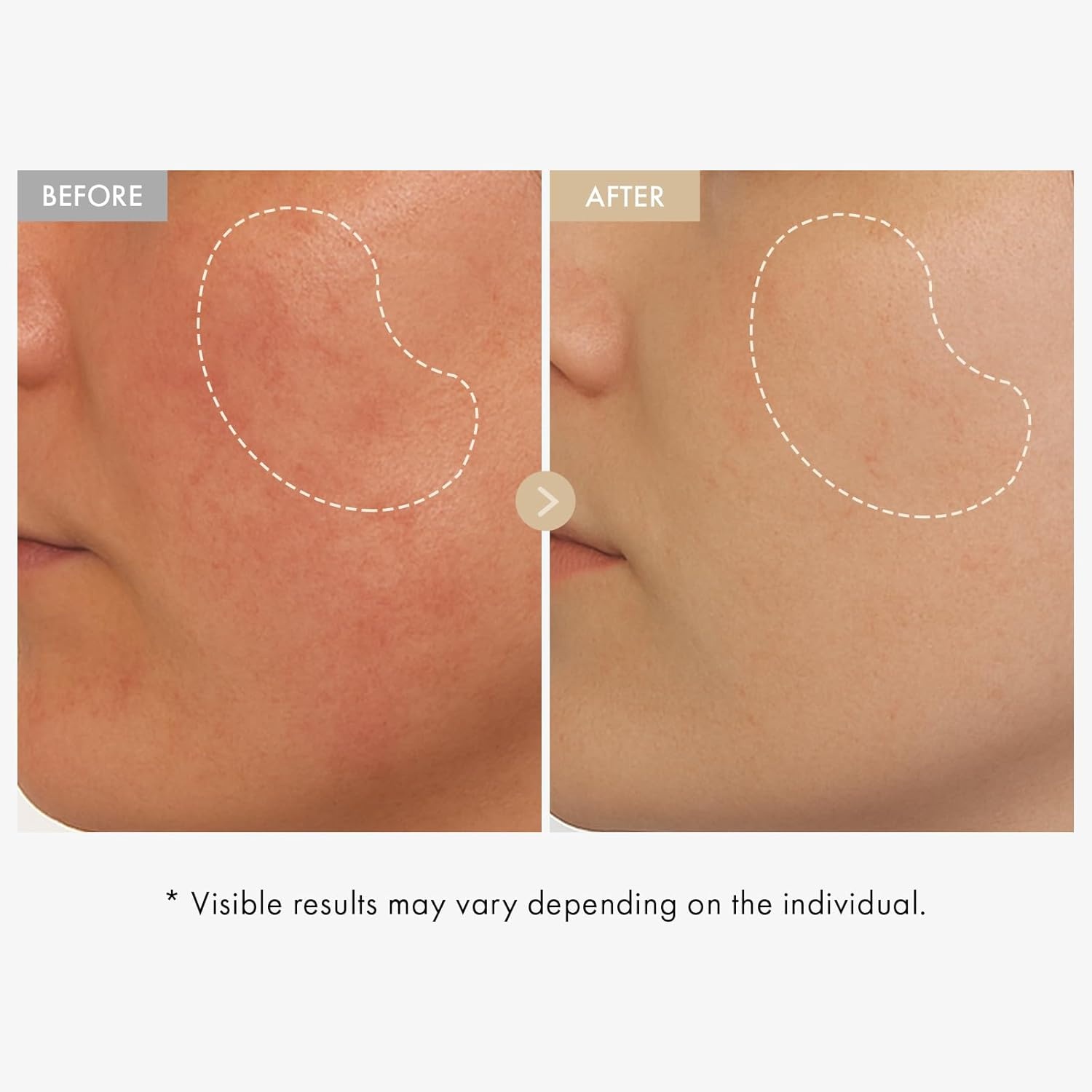 TOSOWOONG Dark Spot Care Duo, Real Rice Glow Serum and Arbutin 7% Tranexamic Acid 4% Cream, Korean Skincare Set with 80% Rice Bran Water, Niacinamide, Glutathione for Uneven Skin Tone, Discoloration - view 2