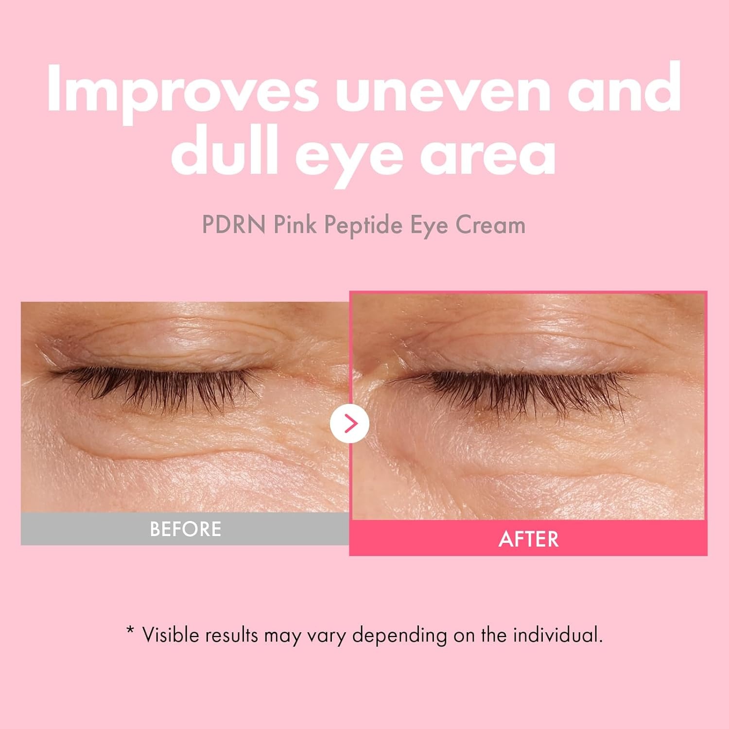 Radiant Youth Duo: TOSOWOONG PDRN Pink Peptide Eye Cream & 12 PDRN Serum for Fine Lines, Dark Circles, and Dull Skin