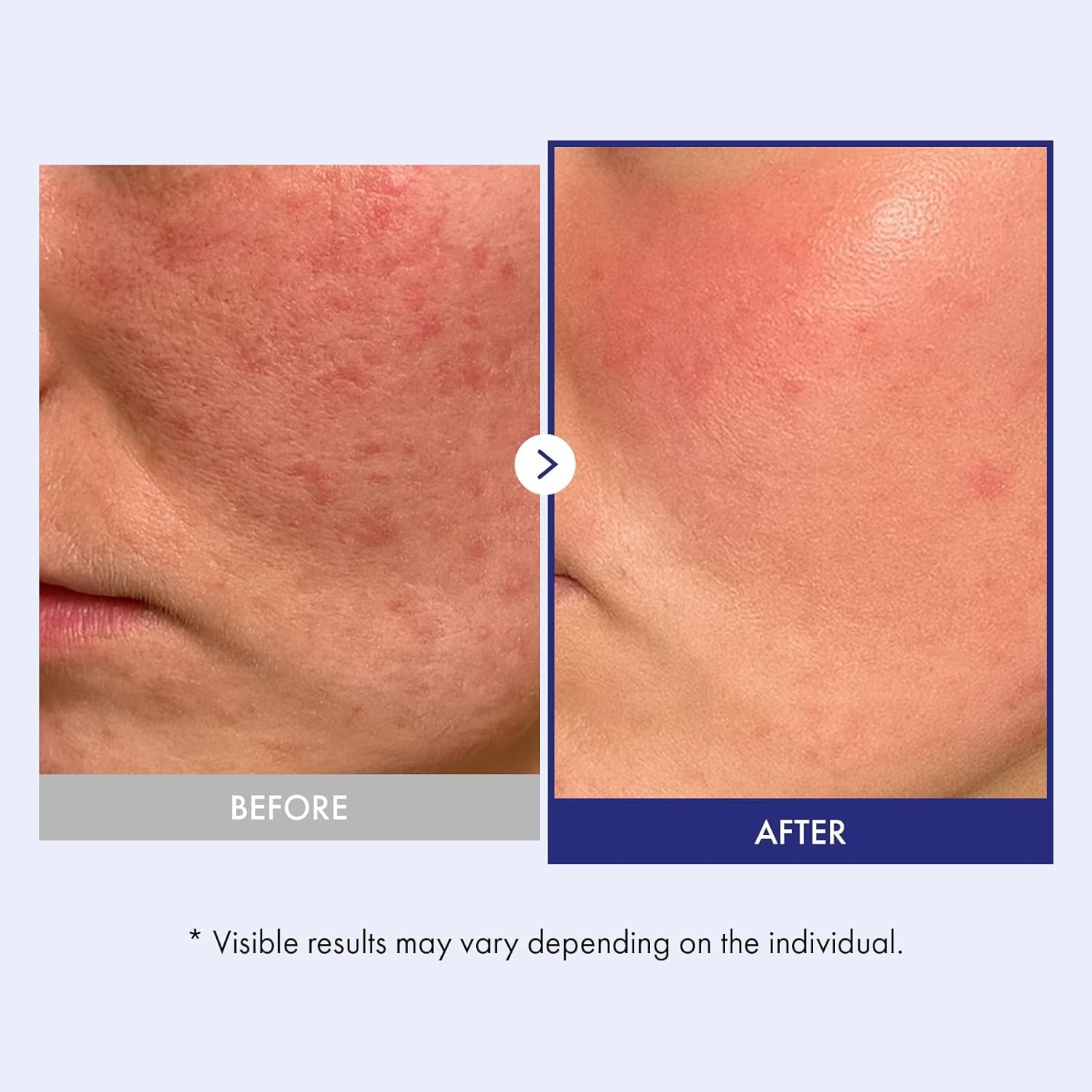 TOSOWOONG Ultimate Barrier Care Duo Panthenol 20 Cream & Ceramide Barrier Serum for Deep Hydration and Skin Protection - view 2