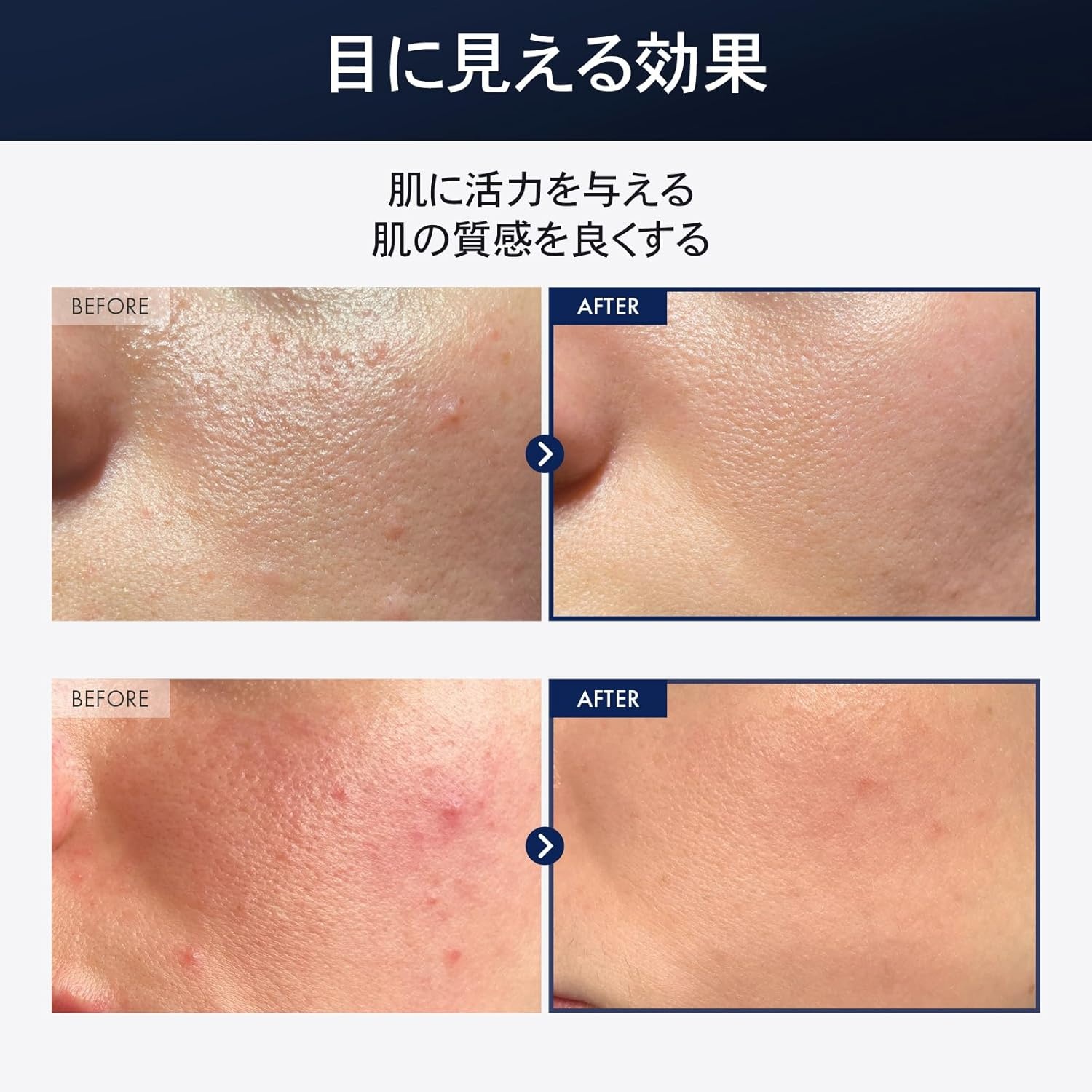 TOSOWOONG Hydrate and Tone Duo, Black Snail Plus Essence and Niacinamide 10% Arbutin 7% Serum, Korean Skincare Set with 96% Snail Mucin, Glutathione for Dark Spots, Hyperpigmentation, Glass Skin - view 2