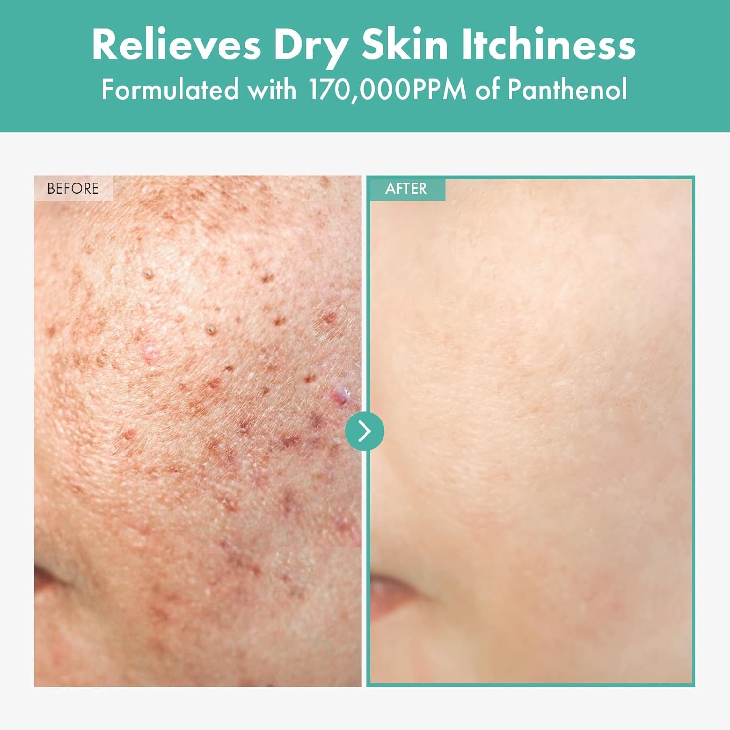 TOSOWOONG Skin Recovery Duo Dexpanthenol Cream & Niacinamide 10% Arbutin 7% Serum for Hydration and Tone Correction - view 5
