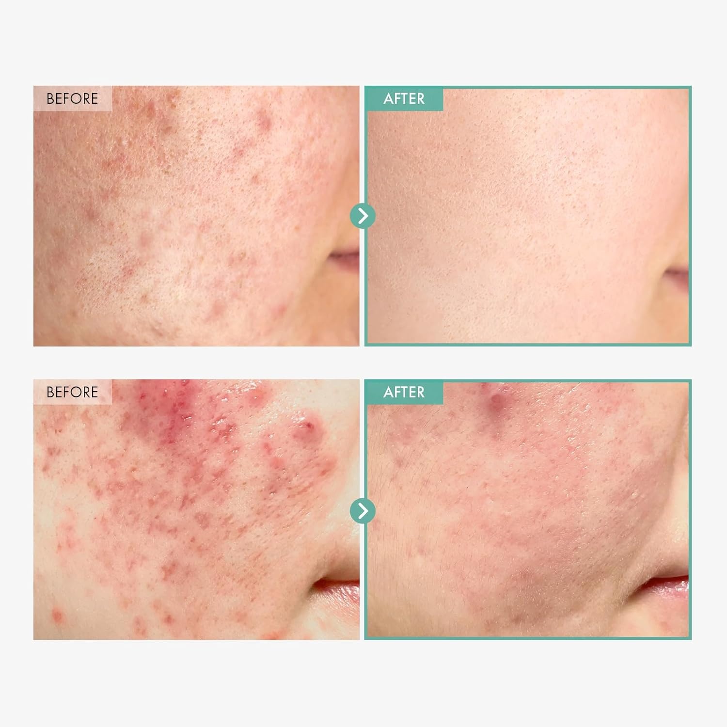 TOSOWOONG Skin Recovery Duo Dexpanthenol Cream & Niacinamide 10% Arbutin 7% Serum for Hydration and Tone Correction - view 6