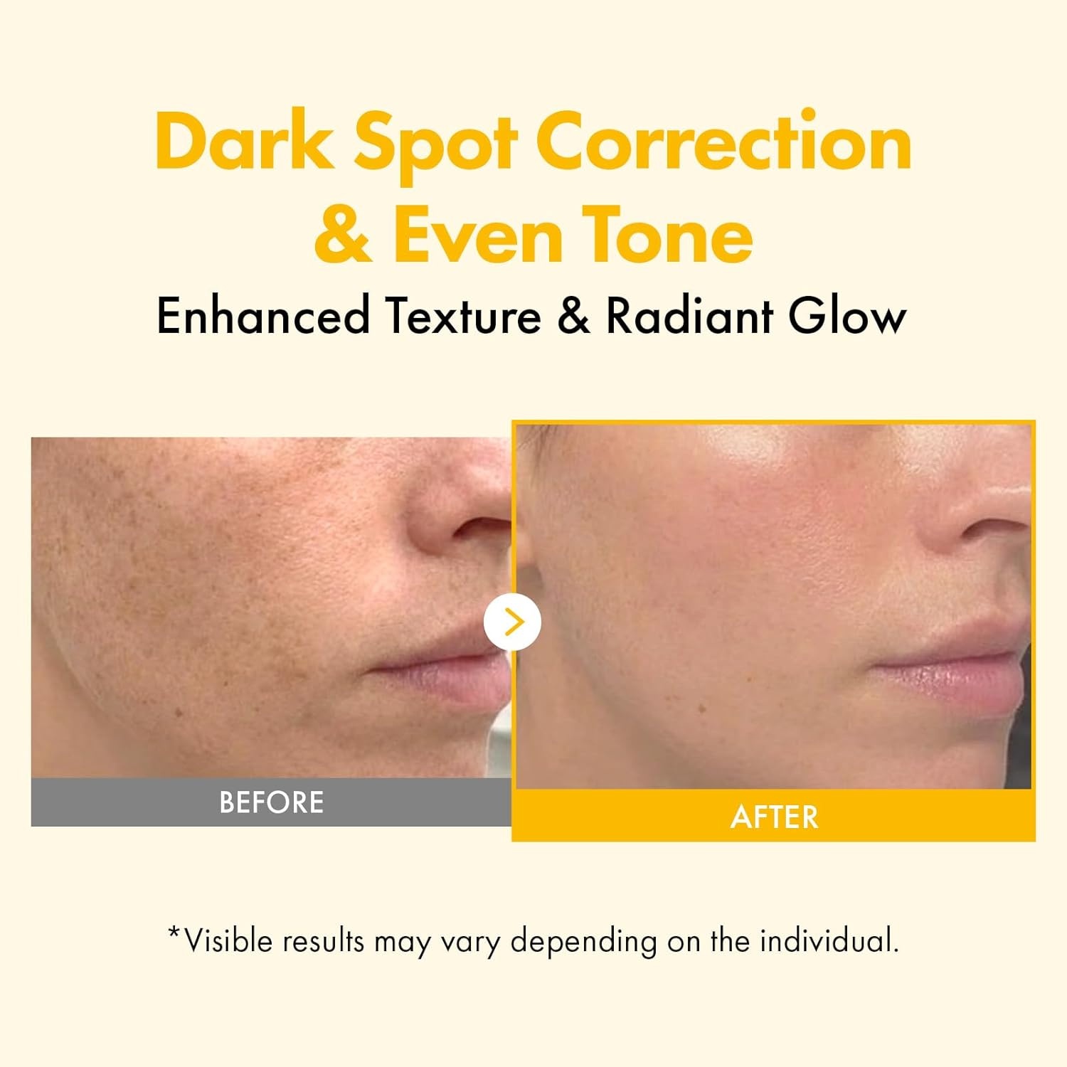 TOSOWOONG Kojic Acid Turmeric Overnight Wrapping Mask, 80% Turmeric Peel Off Facial Mask for Glass Skin, Niacinamide, Retinol & Vitamin C for Dark Spot Remover, Korean Skincare, 75 ml / 2.53 fl. oz.