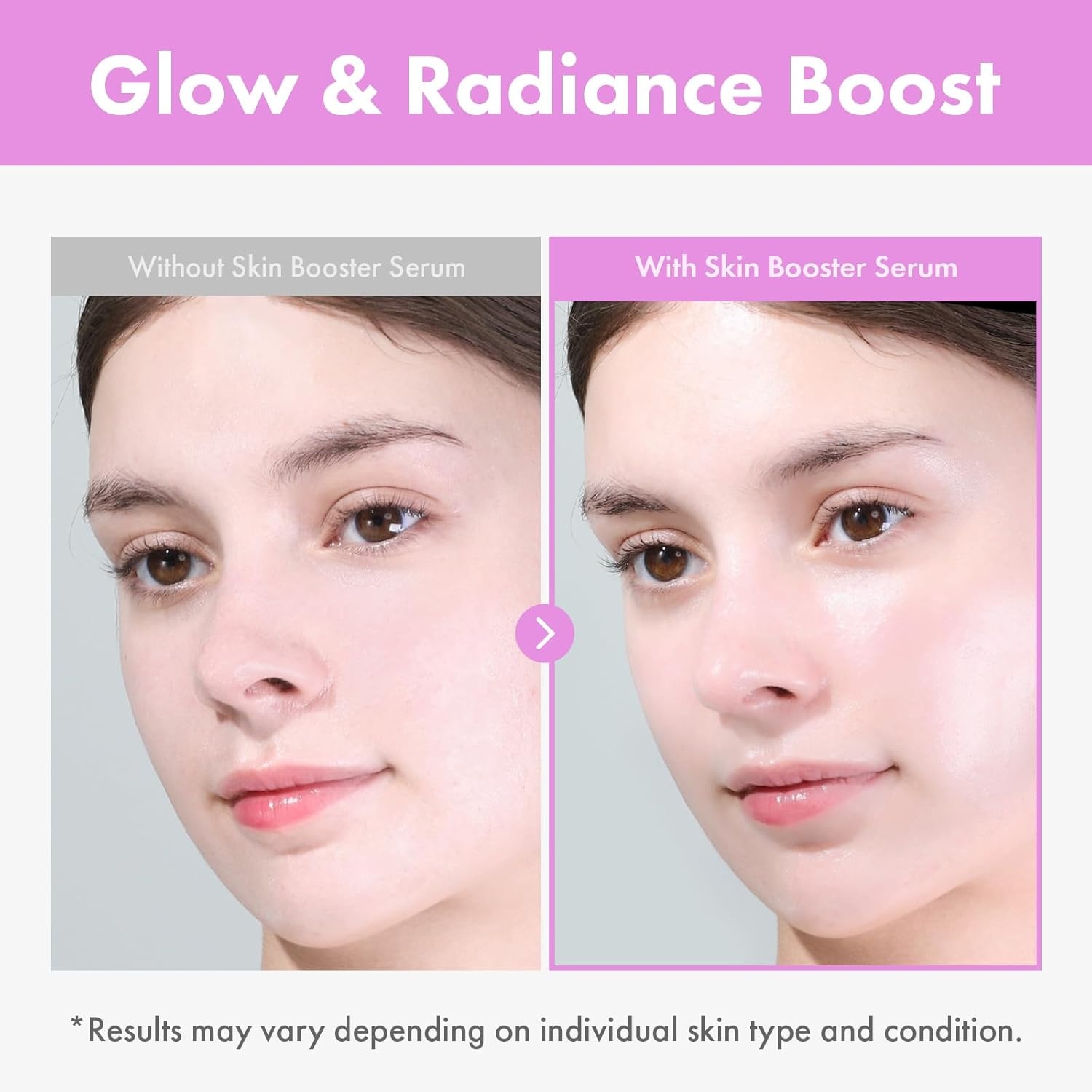 TOSOWOONG 9 Peptide Skin Booster Serum, Niacinamide & Hyaluronic Acid Skin Renewal Boosting Facial Essence for All Skin Types, Korean Skin Care, Paraben Free, 150ml, 5.07 fl.oz. - view 3