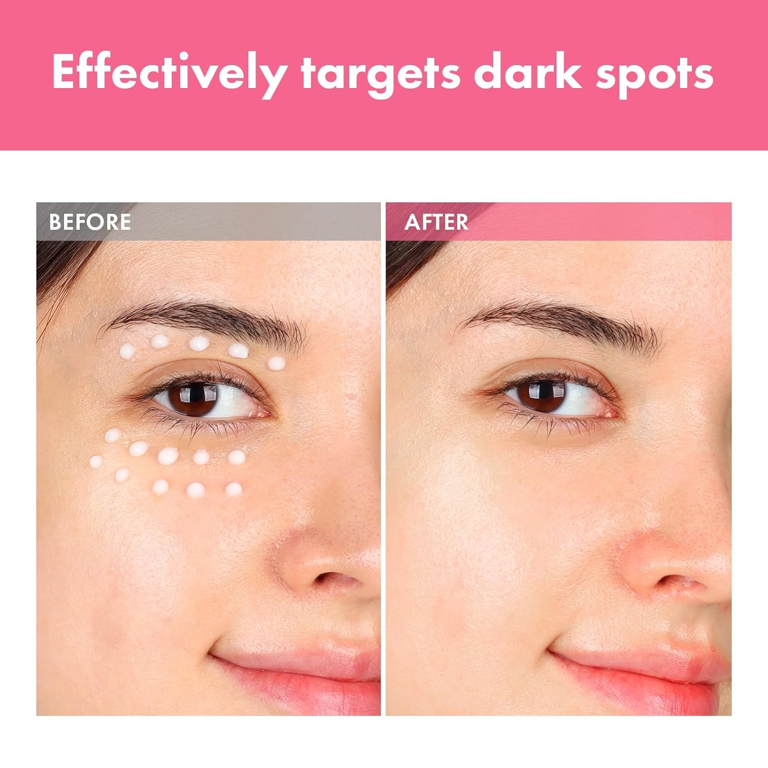 TOSOWOONG Arbutin 7% Intensive Spot Cream with 70,000ppm Arbutin, 3% Tranexamic Acid, 1% Niacinamide, Glutathione, Dark Spots, freckle, Blemishes, Anti-pigmentation, Korean Skin Care, 20ml, 0.67 fl.oz - view 2