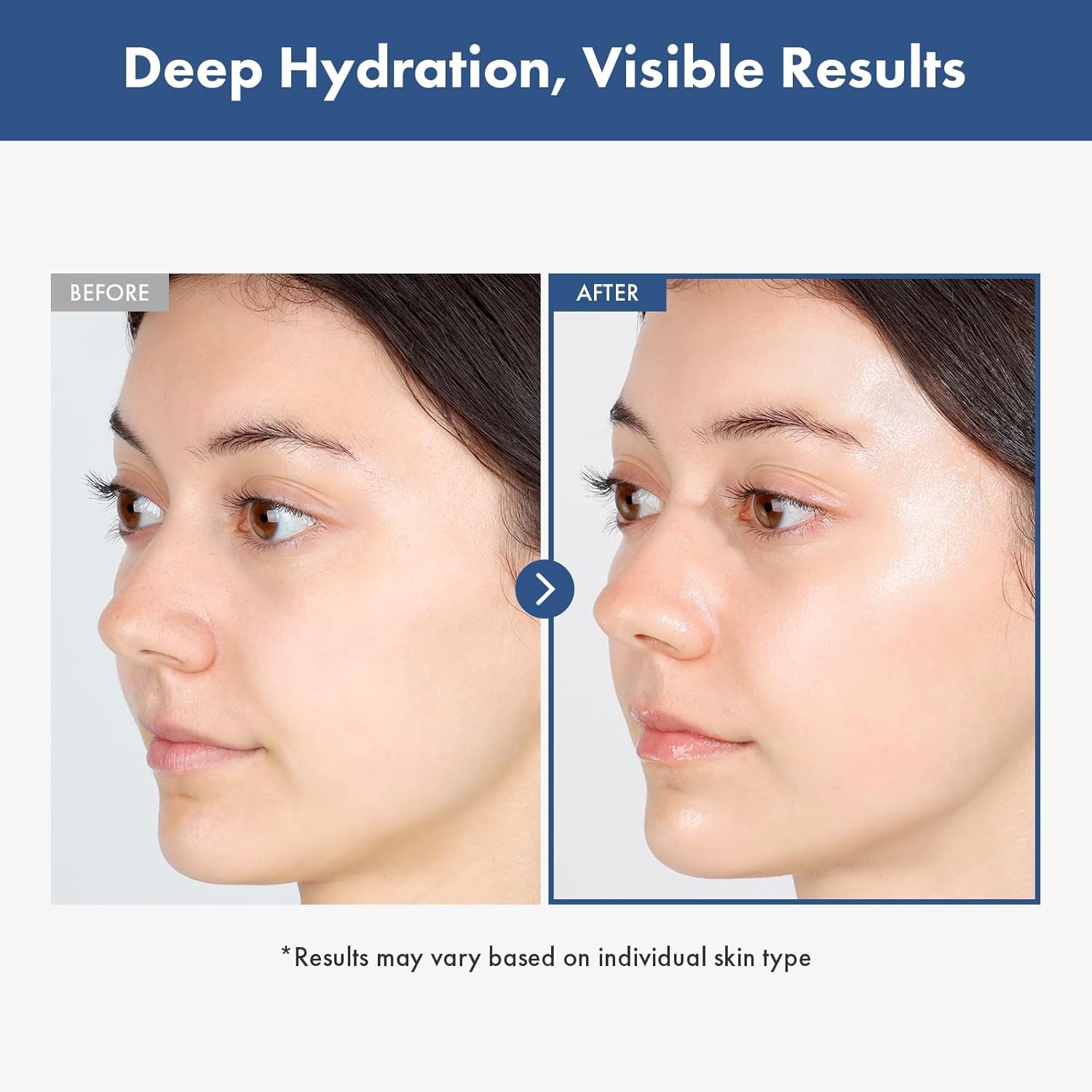 TOSOWOONG Hyaluronic Acid 3% Serum, 30,030ppm Sodium Hyaluronic Acid, Hydration, Moisture Boosting Facial Serum for Fine Lines & Wrinkles, Plump & Repair Dry Skin, Korean Skin Care, 30ml, 1.01 fl.oz. - view 3