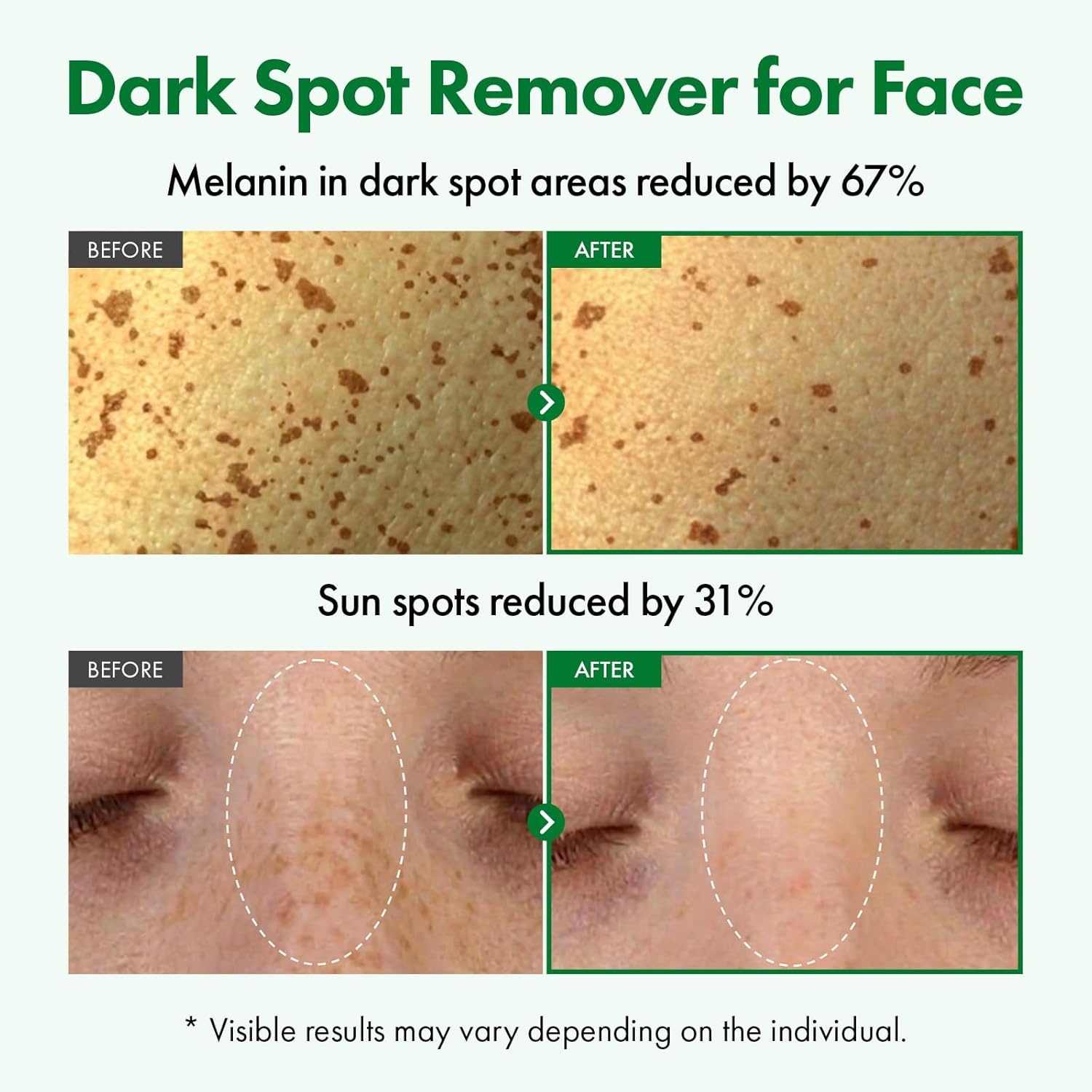 TOSOWOONG Dark Spot Correcting Serum for Hyperpigmentation, Brightening Dull Skin with 58% Rice Bran Water, 5% Niacinamide, Glutathione and Alpha-Arbutin, Korean Skincare, 50 ml / 1.69 fl. oz. - view 2