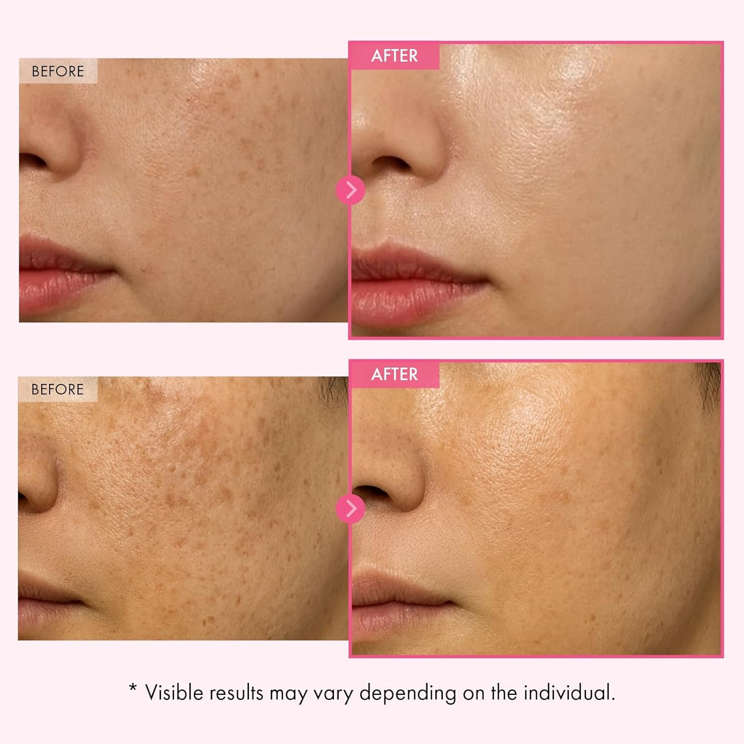 TOSOWOONG Arbutin 7% Glutathione Cream, 70,000ppm Arbutin + 5,001ppm Glutathione, Niacinamide, Dark Spots, Freckle, Blemishes, Pigmentation, Dullness, Uneven Tone, Korean Skin Care, 50ml, 1.69 fl.oz. - view 3