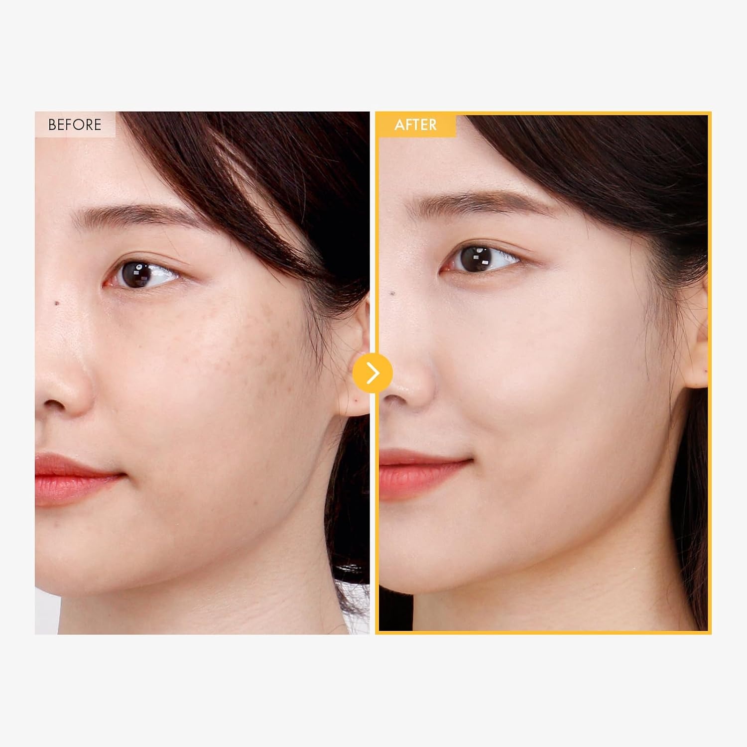 TOSOWOONG 8 Days Spot Cream, Dark Spot Remover for Face, Age Spot, Sun Spot, Freckles, Melasma, Brown Spot Serum, Advanced Formula Corrector Cream with Niacinamide for Women and Men, 50g, 1.76 oz. - view 2