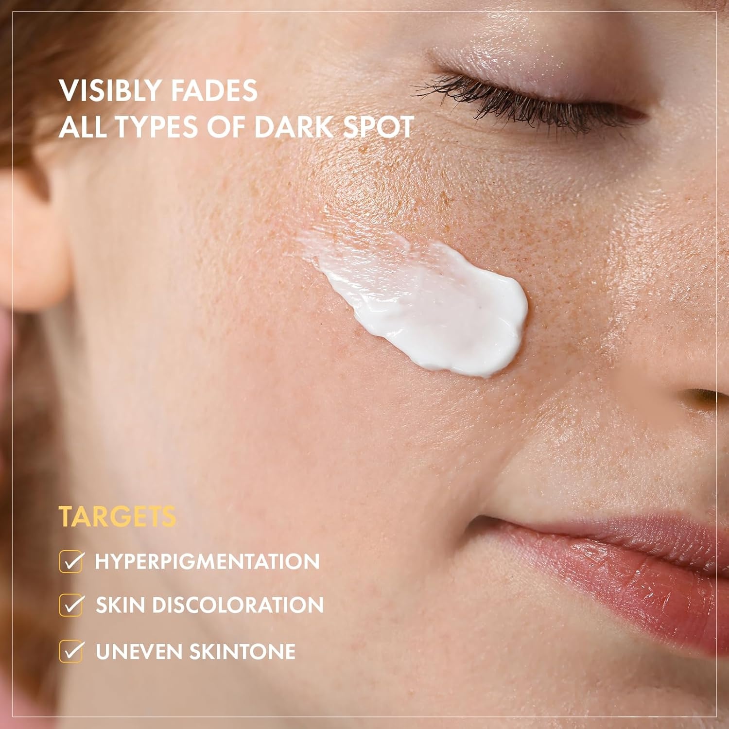 TOSOWOONG 8 Days Spot Cream, Dark Spot Remover for Face, Age Spot, Sun Spot, Freckles, Melasma, Brown Spot Serum, Advanced Formula Corrector Cream with Niacinamide for Women and Men, 50g, 1.76 oz. - view 3