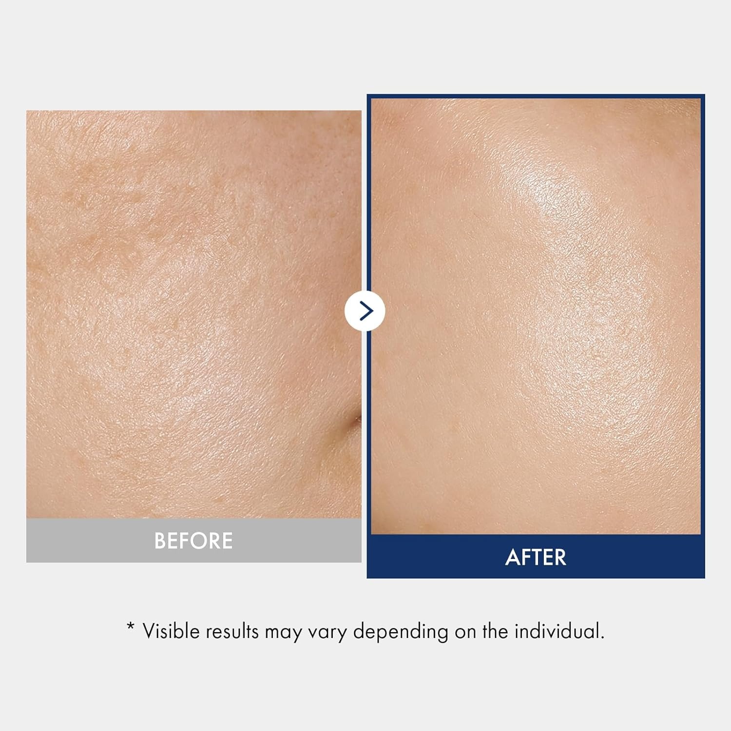 TOSOWOONG Ceramide Barrier Serum, Hydrating Serum for Face, 1,250ppm Ceramide Complex, Niacinamide, Collagen, Panthenol, Centella, Glass Skin, Fragrance-free, Korean Skin Care, 33 ml / 1.11 fl. oz. - view 3