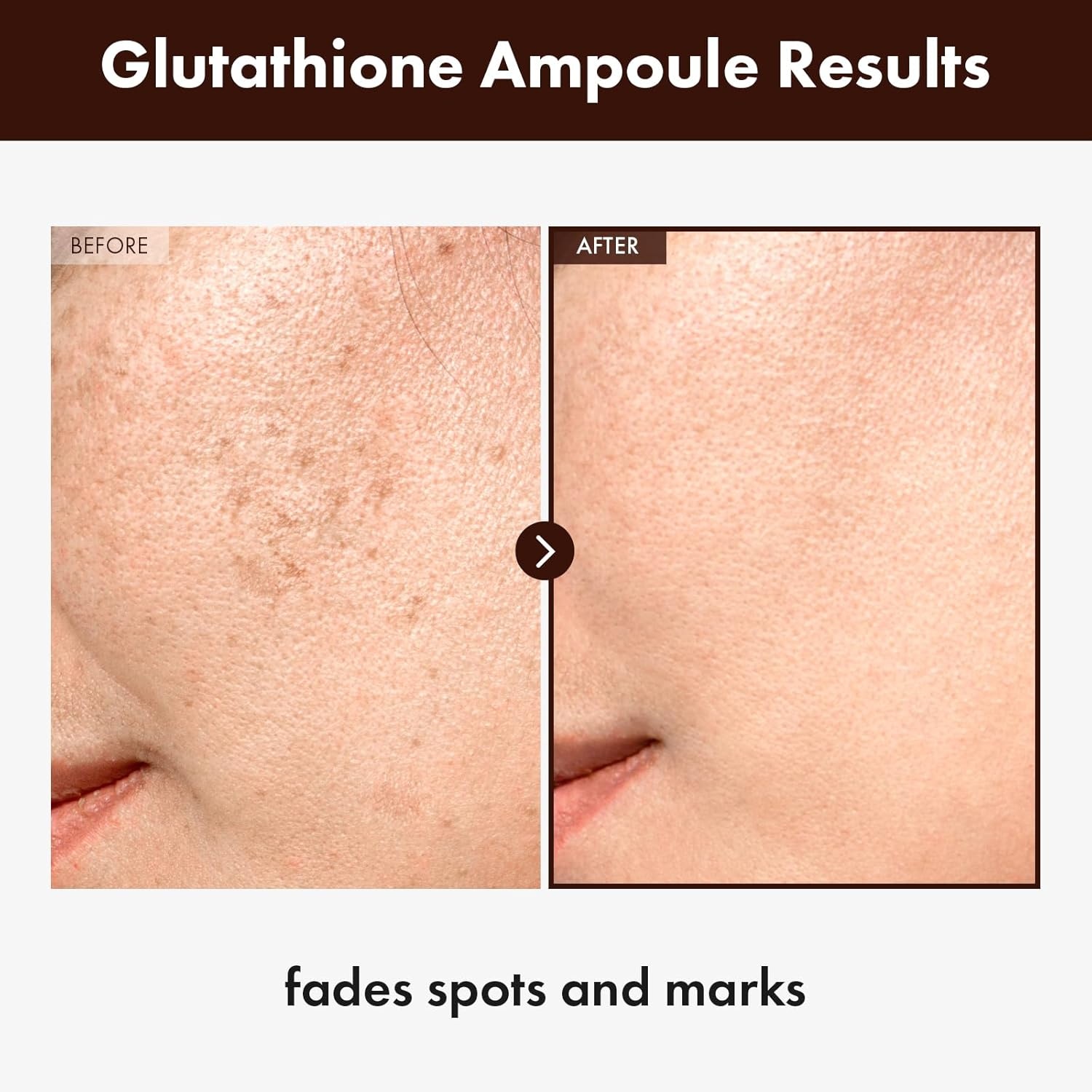 TOSOWOONG Glutathione Serum with 20,000ppm Glutathione, Niacinamide and hyaluronic acid, Dark Spot, Improve skin elasticity, Revitalize complexion, Korean Skincare, 30ml, 1.01 fl. oz.(Glutathione Serum)
