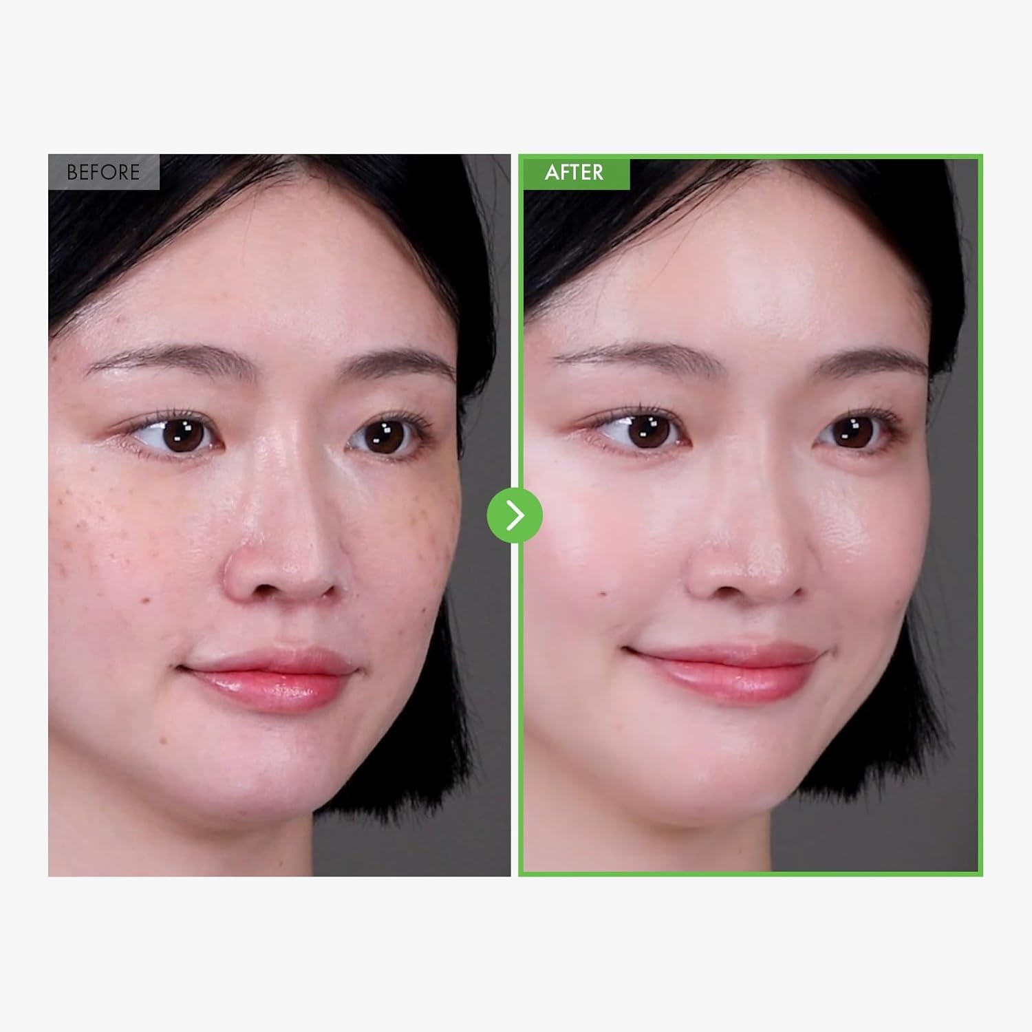TOSOWOONG Kakadu Plum Blemish Cream, Dark Spot Remover for Face Cream, Kakadu Plum 600,000ppm, Niacinamide, Adenosine, Betaine, Dark Spot Corrector, Vitamin C, Korean Skin Care, 50g, 1.76 oz. - view 2